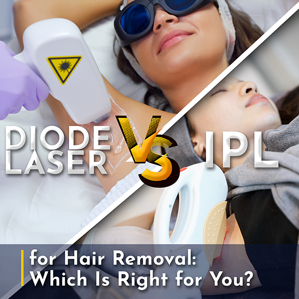 Image of Diode Vs IPL Hair removal treatment